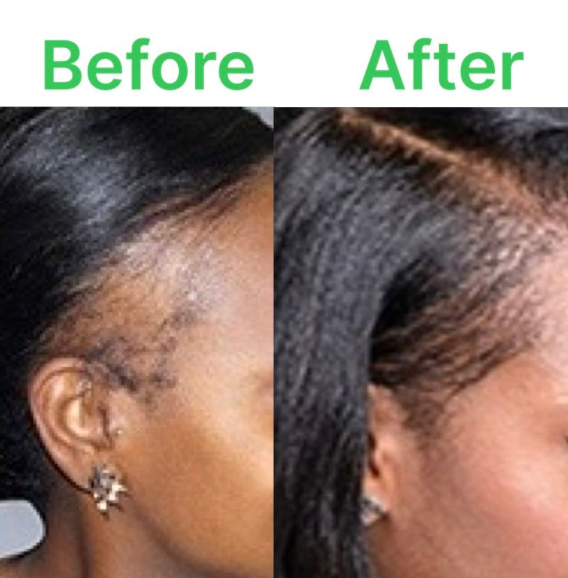 Toshie Hair All Natural Hair Growth Serum No Minoxidil